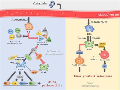 Macrophages: A communication network linking Porphyromonas gingivalis infection and associated systemic diseases